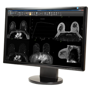 DynaCAD Site License - Breast DynaCAD Site License - Breast