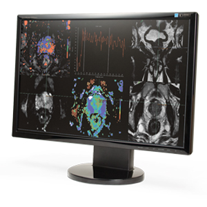 DynaCAD Breast and Prostate Software DynaCAD Breast and Prostate Software